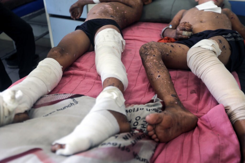 Dos niños palestinos reciben tratamiento por heridas graves tras una explosión causada por un artefacto explosivo sin detonar dejado por las fuerzas israelíes, en el Hospital Al-Shifa, en la ciudad de Gaza.