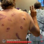Llegada compañer@s de la flotilla a Estambul, con señales de haber sido maltratad@s.