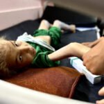 Huda Abu Al-Naja, de 12 años, recibe tratamiento por desnutrición en el Hospital Nasser de Gaza, el 25 de junio de 2025.