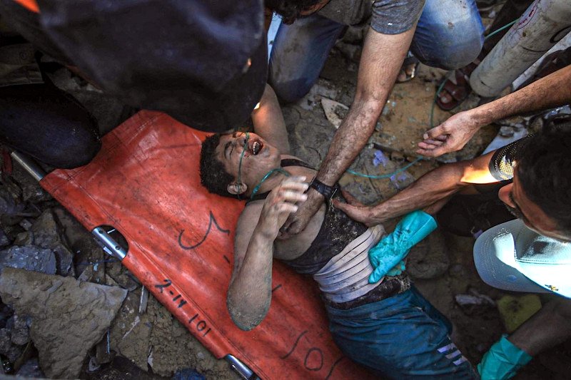 Un niño herido por los bombardeos es atendido por sanitarios en Gaza, el 12 de noviembre de 2023. / Mohammed Zannoun.
