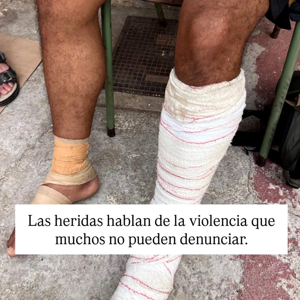 Las heridas hablan de la violencia que muchas personas migrantes no pueden denunciar.