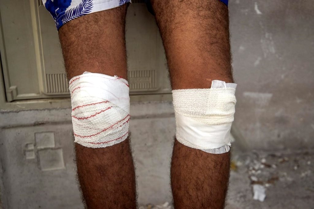 Una persona muestra sus heridas durante su estancia en Ceuta.