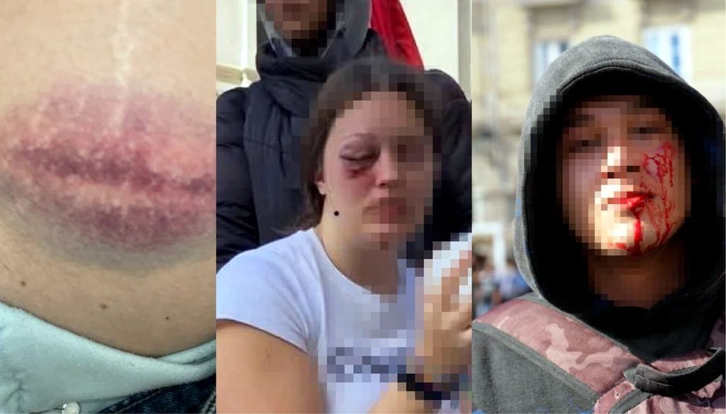 Tres de las personas heridas durante las cargas policiales en A Coruña este miércoles pasado.
